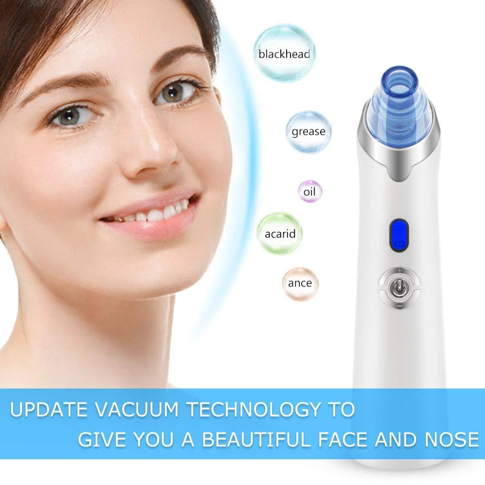 Electric Blackhead Remover with 4 Suction Heads X1971