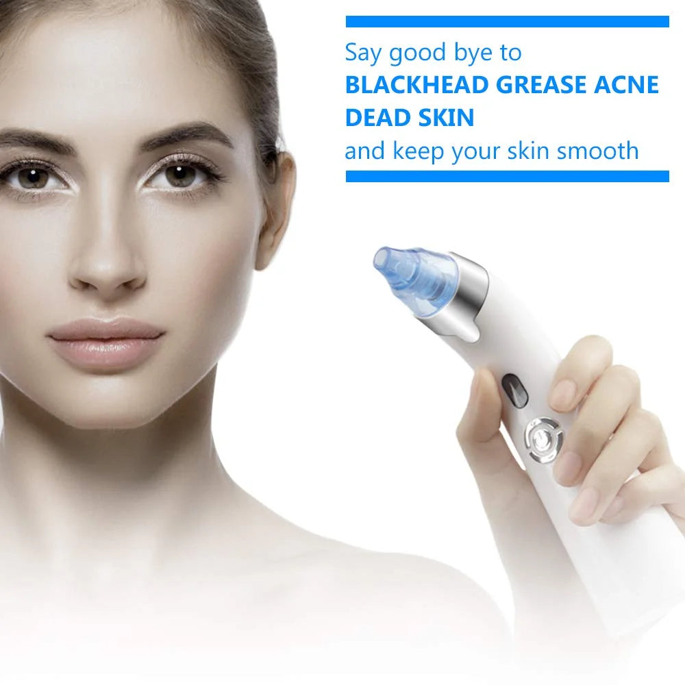 Electric Blackhead Remover with 4 Suction Heads X1971