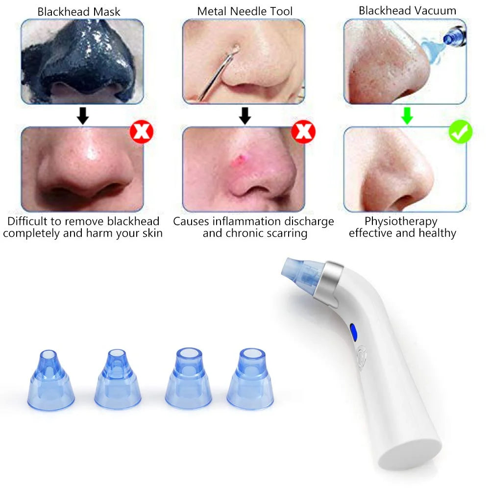 Electric Blackhead Remover with 4 Suction Heads X1971